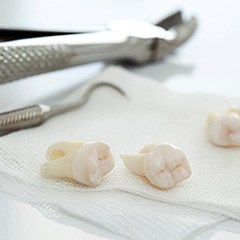 Dental forceps and extracted teeth