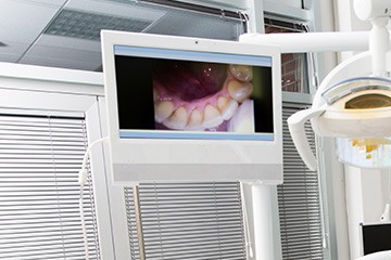 Intraoral photos on computer screen