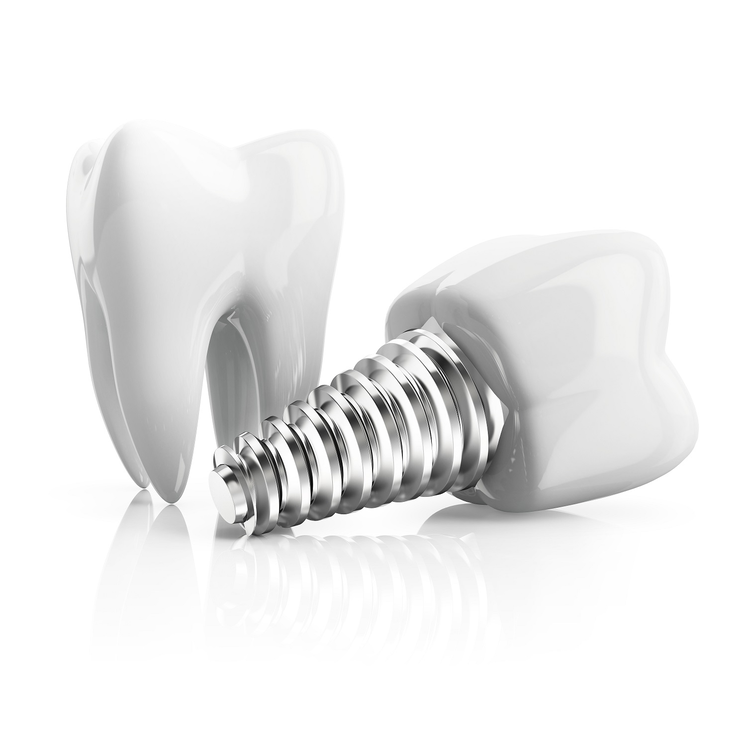 Get Dental Implants In Naples For A Complete Smile