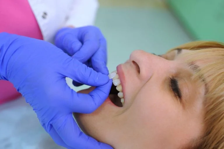 Straight Smiles: Can Veneers Realign My Teeth?