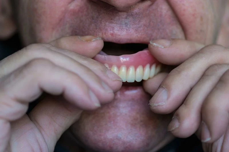Replacing Teeth When You’ve Been Missing Them For a Long Time