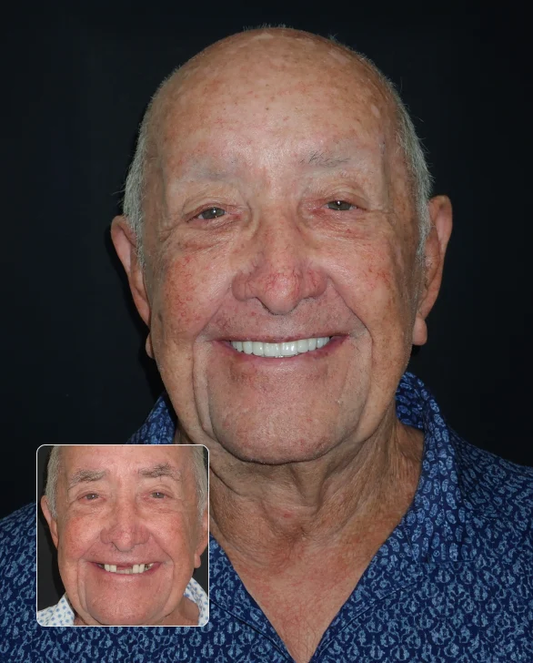 Smiling older man in a blue patterned shirt with an inset photo of his earlier smile