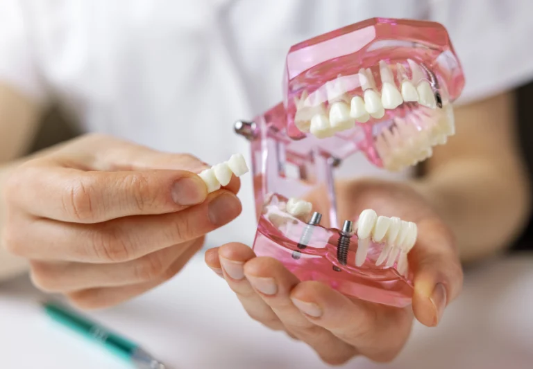 Know the Qualities of a Good Dental Implant Candidate