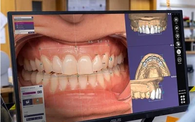 Smile Trials in Naples, FL